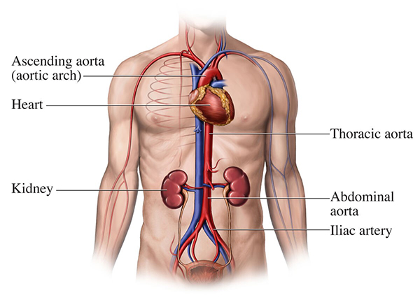 A diagram of the aorta, including the heart, kidneys, and major veins and arteries.