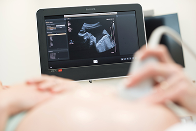 Ultrasound technologists play an important role in prenatal care for OHSU patients