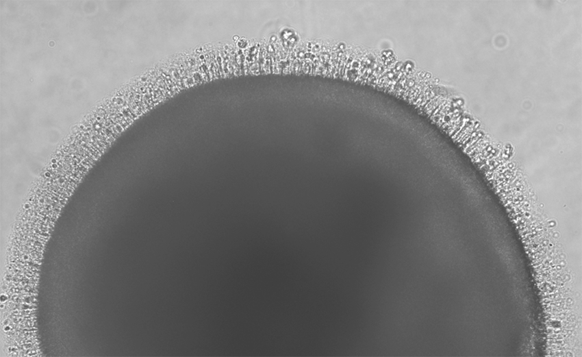 A microscopic retinal organoid after 240 days grown from stem cells.