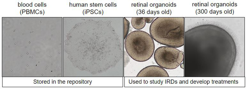 Diagram reviews what steps of growing a retinal organoid and what they look like, from blood to stem cell to organoid at 36 days to organoid at 300 days.
