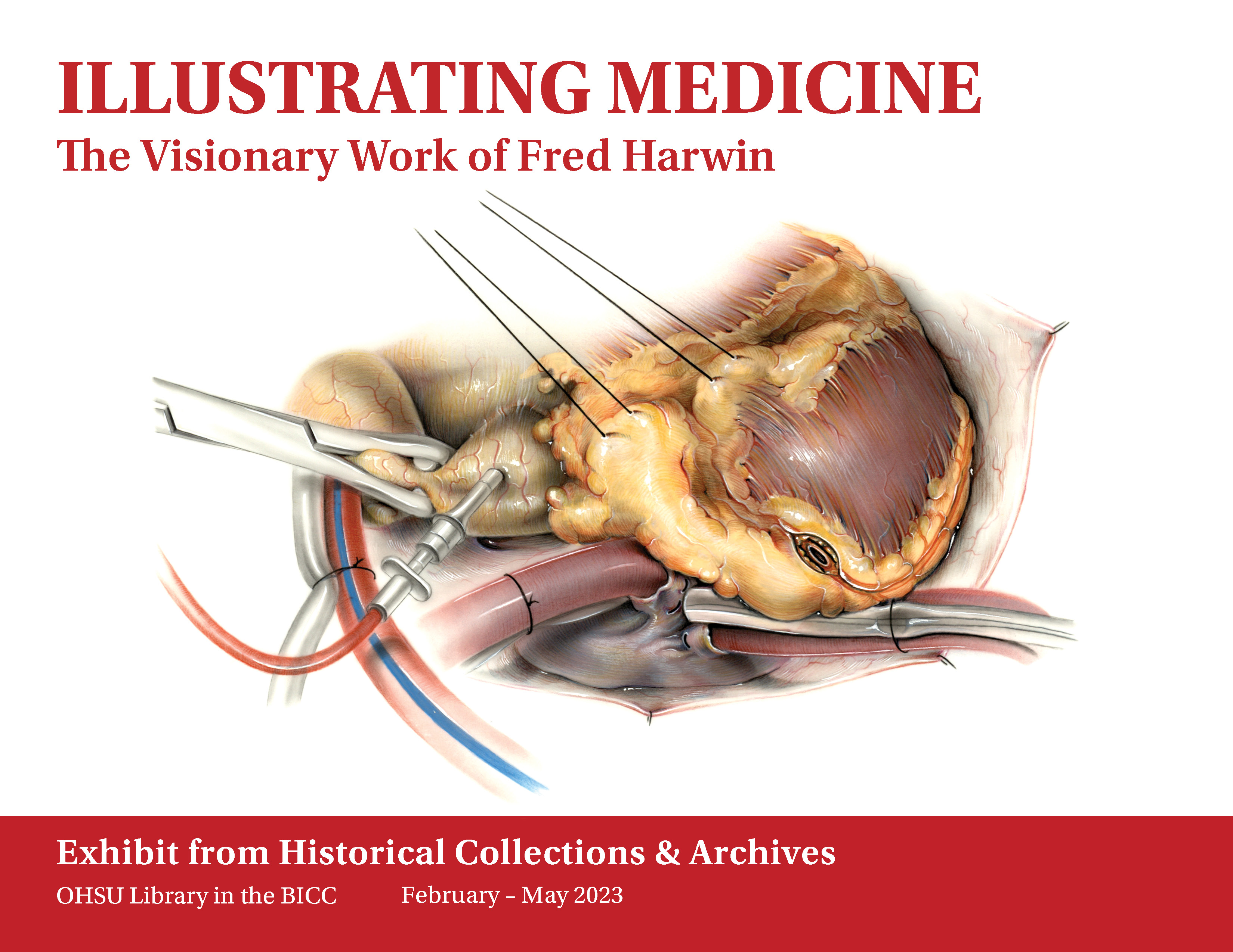 'Illustrating Medicine: The Visionary Work of Fred Harwin. Exhibit from Historical Collections & Archives. OHSU Library in the BICC. February - May 2023." Illustration of open heart surgery in center.