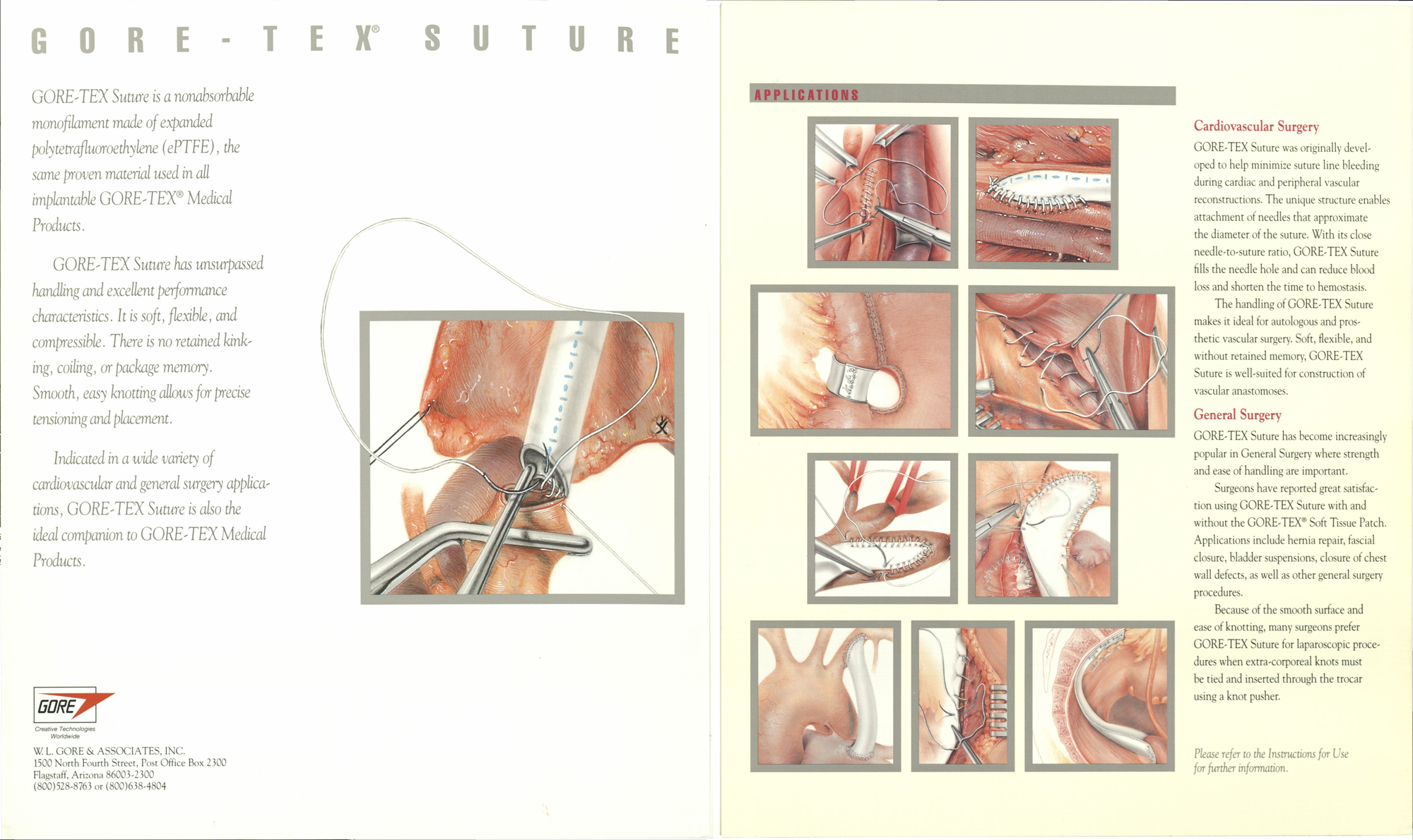 Gore-Tex suture brochure