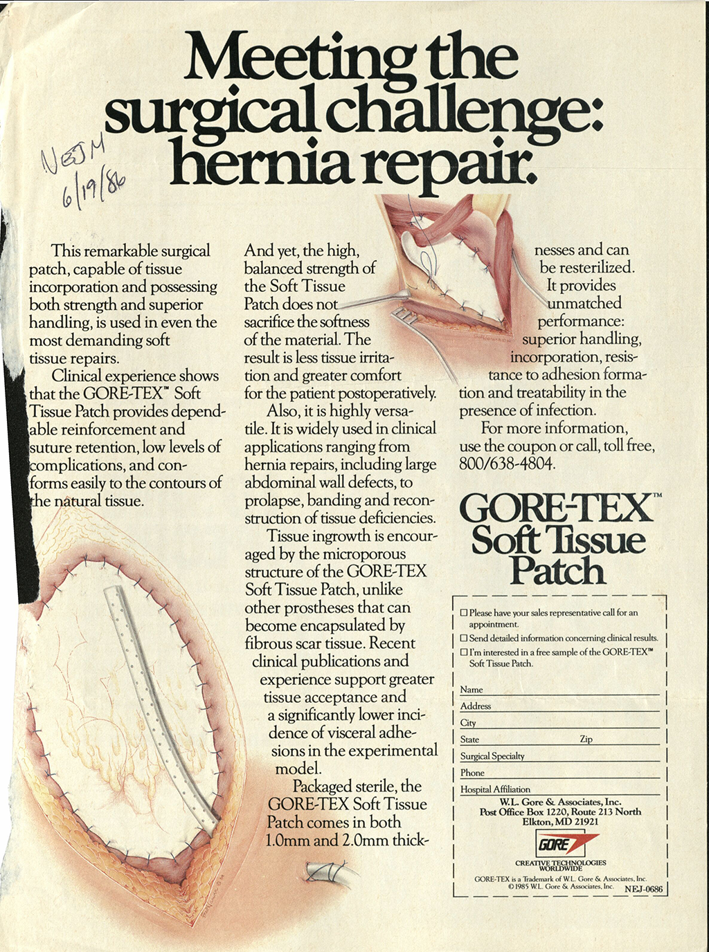 Gore-Tex advertisement for the Soft Tissue Patch. 