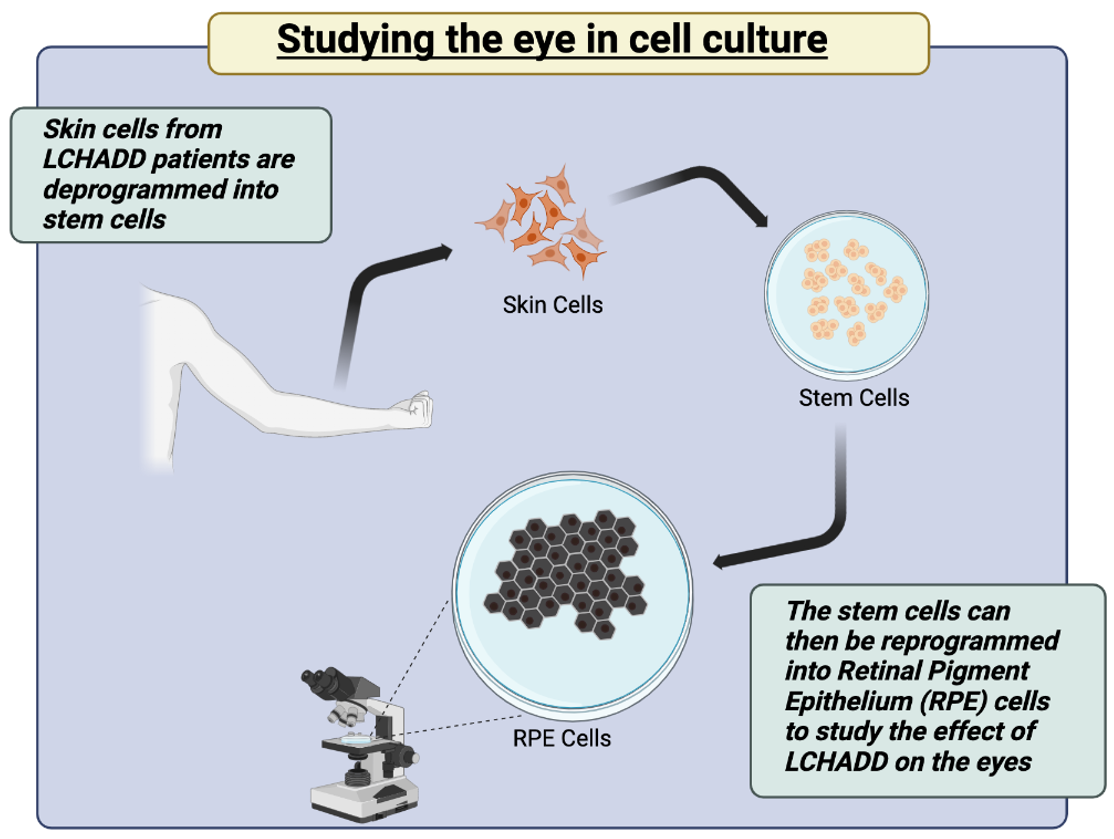 Graphic showing cells from a patient's arm being transformed into stem cells and then retinal pigment epithelium cells or RPE