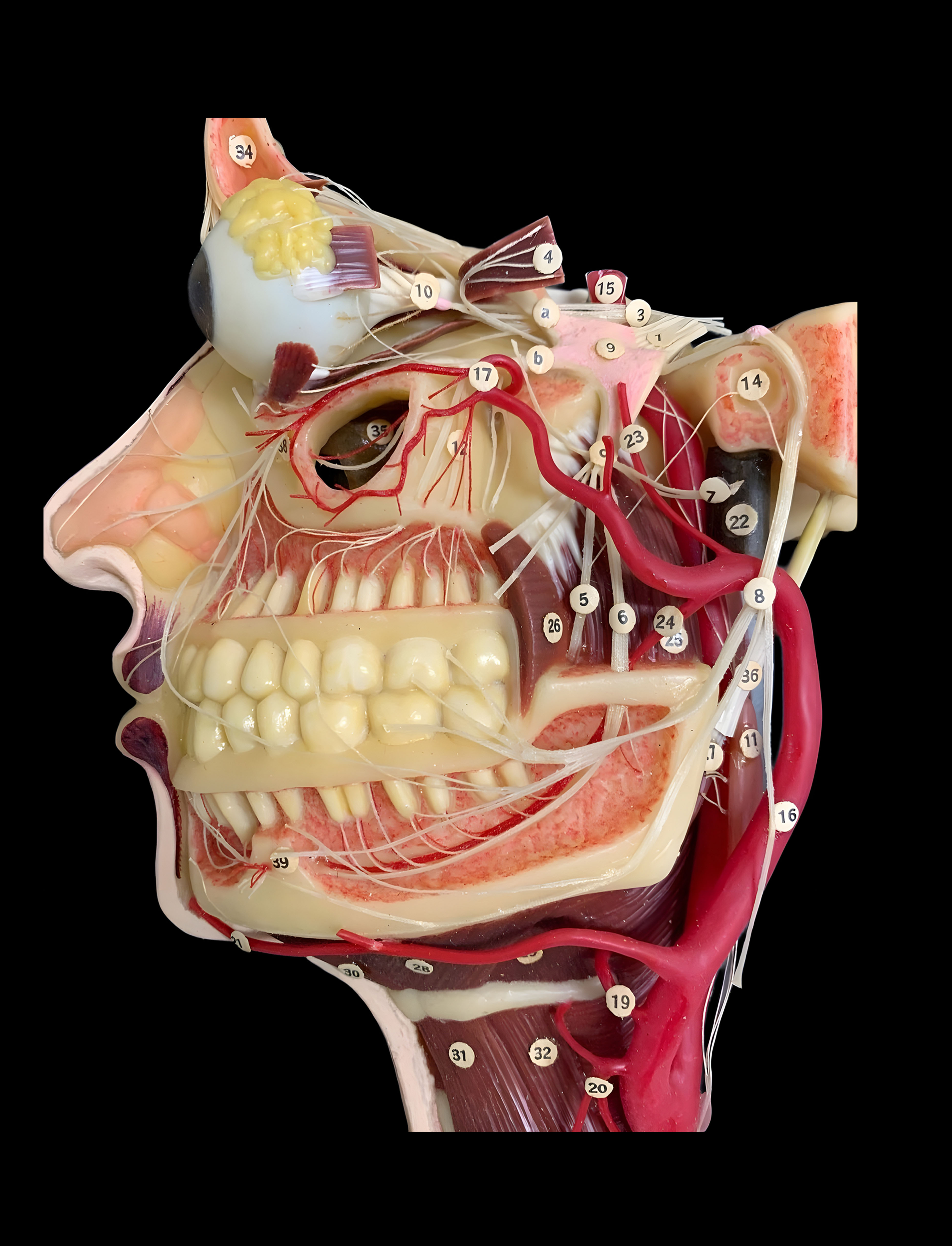 Photograph of 3d plastic model of bisected human skull 