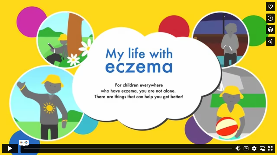 My Life with Eczema video thumbnail
