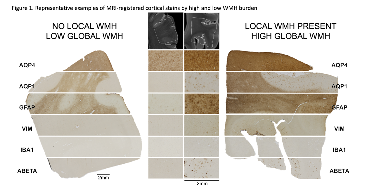 Infographic of how staining is used on MRI samples