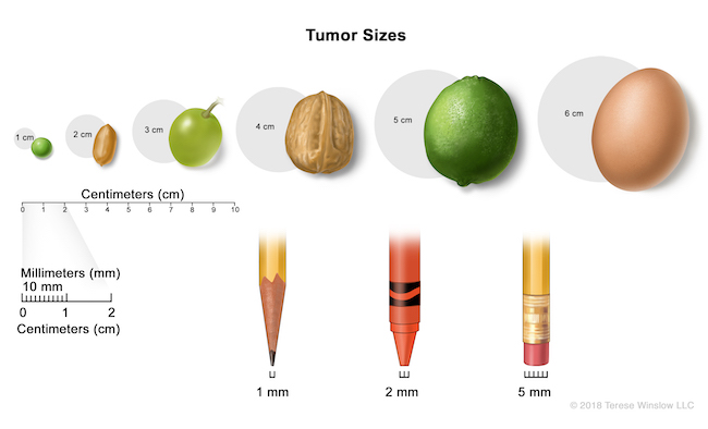 This diagram illustrates tumor sizes compared with everyday items - a pea, a peanut, a grape, a walnut, a lime, an egg, as well as a pencil tip, a crayon tip, and a pencil eraser.