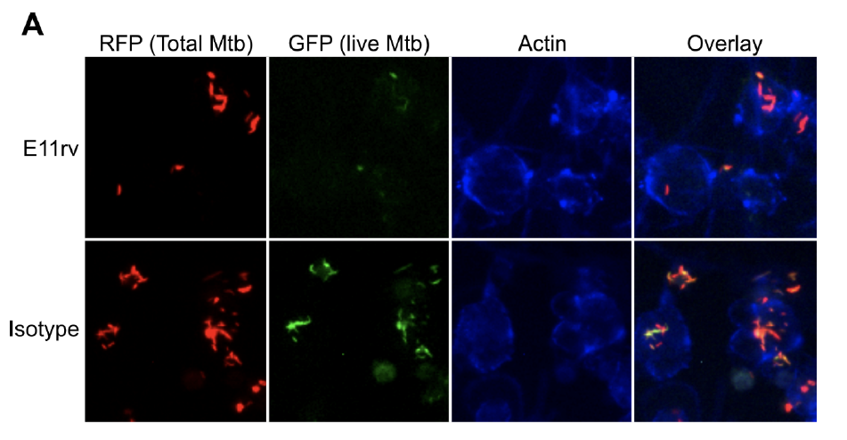 M tuberculosis ESAT-6