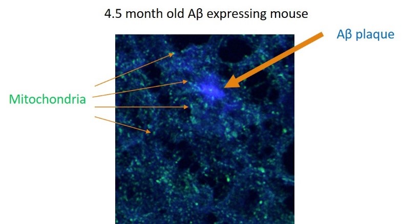 Multiphoton in vivo image of 4.5 month-old mouse with Alzheimer's disease, pointing out mitochondria and β-amyloid (Aβ) plaques