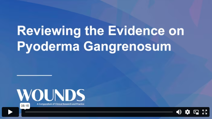 Reviewing the Evidence on Pyoderma Gangrenosum Video