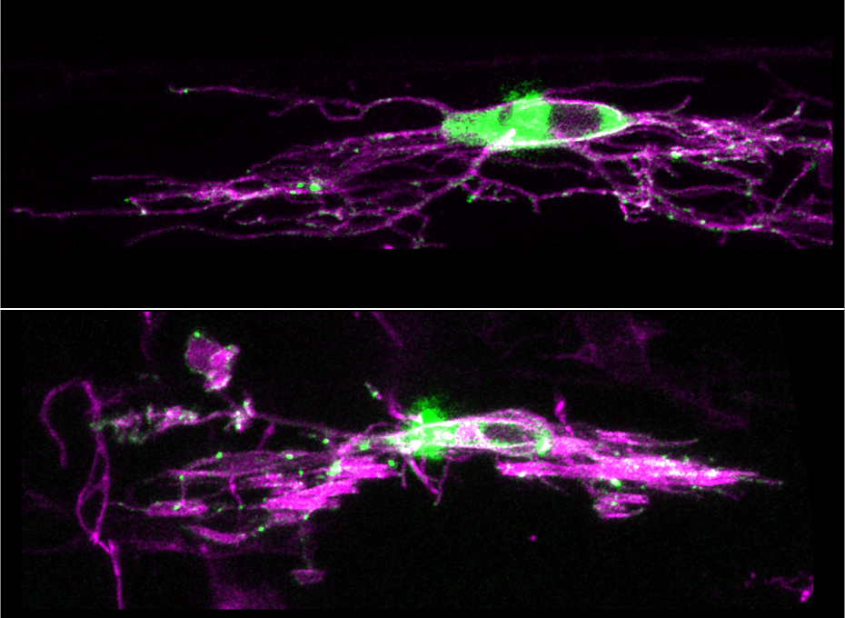  Synapses  This image shows synapses across development of oligodendrocyte precursor cells: OPC (top), and myelinating oligodendrocyte (bottom). Magenta labels the morphology of the cell processes and the green labels synapses. (Contributed)
