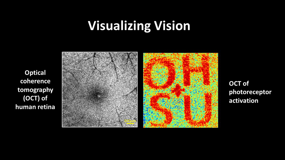 Two images of an OCT scan of a retina sit side by side. On the left is a traditional black and white scan. On the right is a bright yellowish background with the letters O-H-S-U in red.