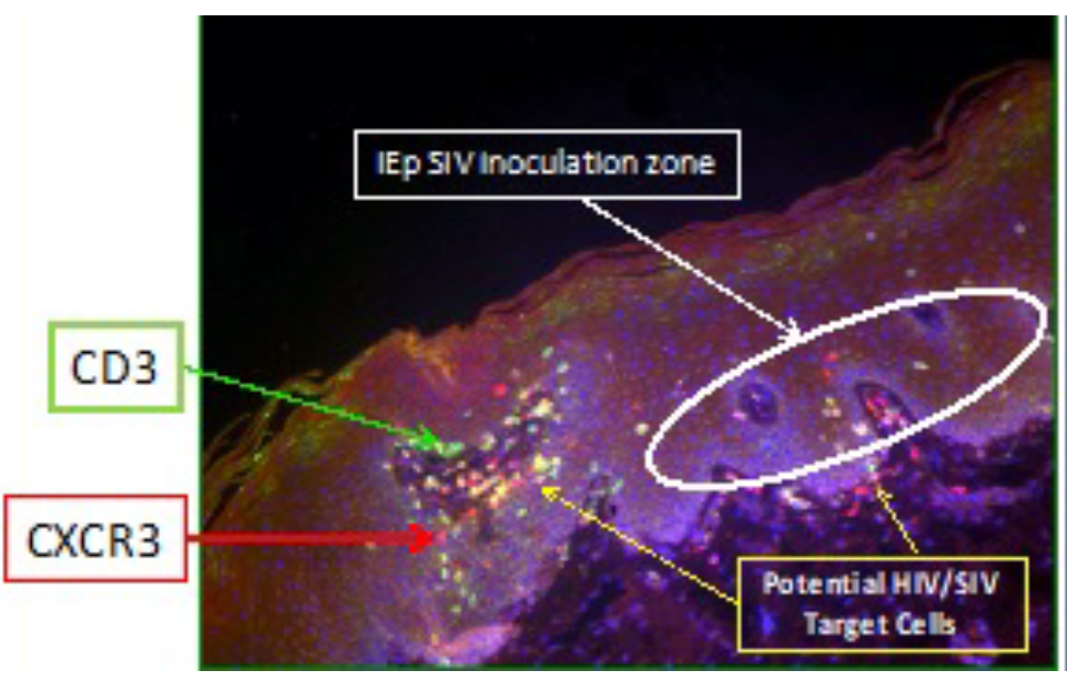 Images represent the immune cell population at the site of intraepithelial injection and the use of this model to study early events in SIV transmission from the mucosa to the local draining lymph node and then systemic spread.