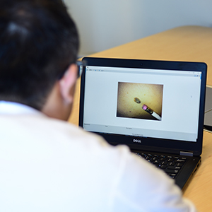 A doctor views an image of a potential cancerous mole on a computer screen