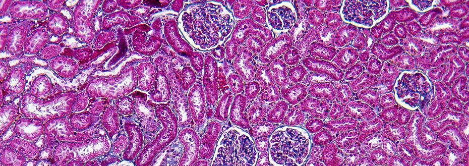 Human kidney cortex section showing Bowman capsules and glomerulus at magnification X100.