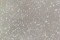 Hundreds of cultured podocytes at 40x magnification are white and pale gray cells on a dark gray background.