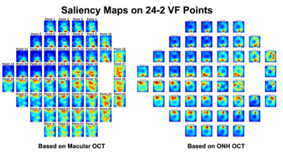 Two side-by-side images shows small squares making up a larger map demonstrating structure to function in visual field.