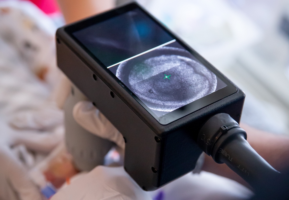 A black device shows an image of a baby's retina.