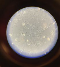 Podocytes cell culture photo