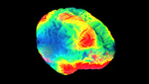 Colorful digital image of a brain scan.