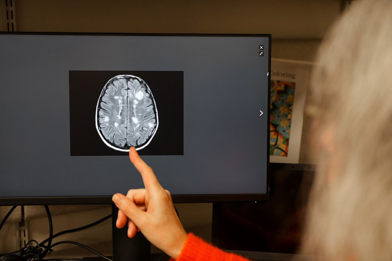 Dr. Rebecca Spain points at a brain scan on a computer monitor.
