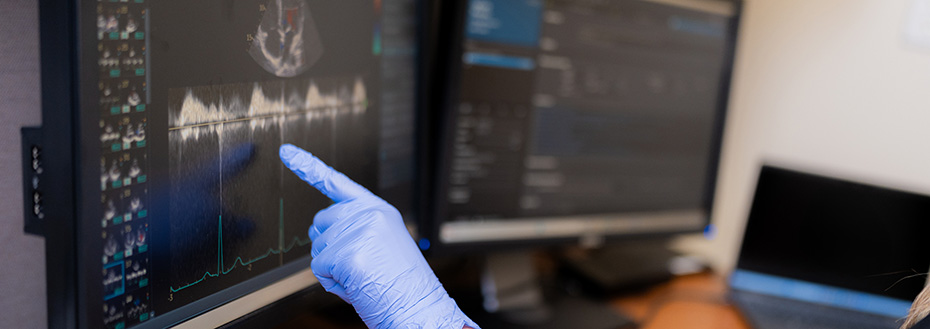 A doctor wearing gloves points at a computer screen that shows the results of an echocardiogram.
