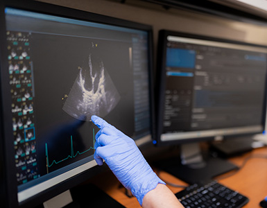 A researcher points at an echocardiogram ultrasound on a monitor.