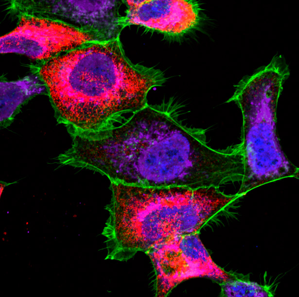 The image shows a microscope view of the subcellular localization of RTK ROS1 in osteosarcoma cells, stained pink, green and violet to make features more visible.
