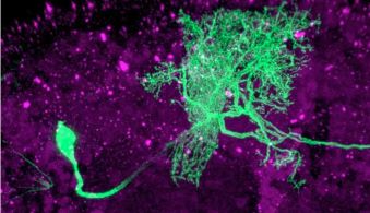 Single Cell Dopamine 