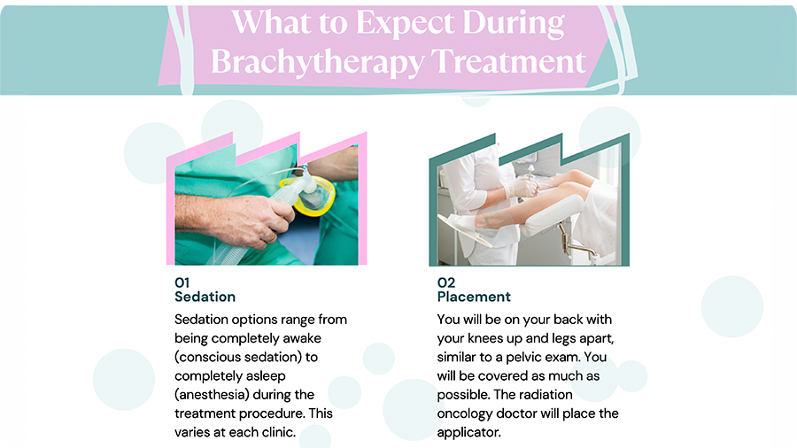 Screenshot showing a patient education webpage about brachytherapy treatment.